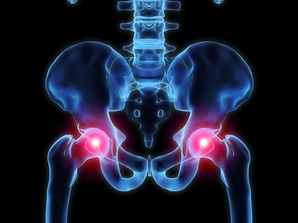 Hip Pain: Causes and Treatment